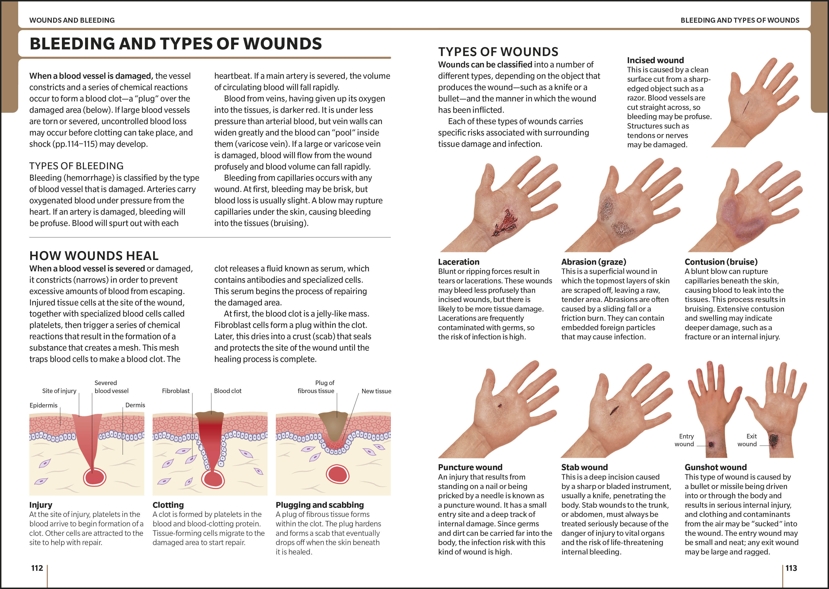 additional book photo